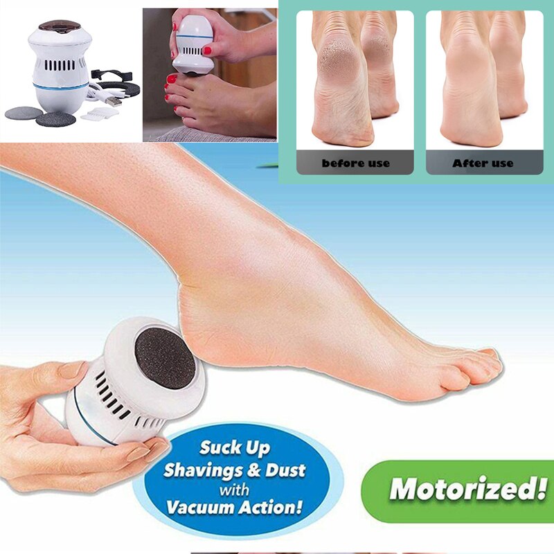Electric Vacuum Foot Grinder